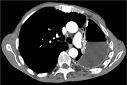 Link to case presentation