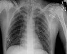 Link to case presentation