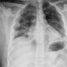 Link to case presentation